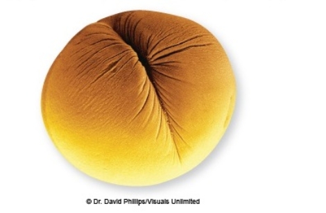 <strong>In the biology lab,you observe animal cells that resemble this first sign of cytokinesis,the formation of this </strong> A) cell plate. B) nuclear envelope. C) cell wall. D) nucleolus. E) cleavage furrow.