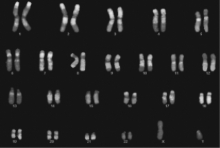 <strong>The karyotype shown is from a(n) </strong> A)male. B)female. C)individual of undetermined sex. D)individual with a genetic disorder.
