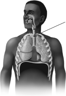 The structure that is highlighted in this figure is the   A) diaphragm. B) bronchi. C) larynx. D) trachea.