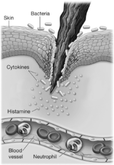 <strong>Which of the following is a white blood cell that will arrive in the next stage of inflammation? </strong> A)a platelet B)a T cell C)a macrophage D)an antibody