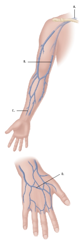 A client is in the emergency department with a burn calculated to be 35% TBSA.The nurse prepares the client for an IV insertion in which location?  