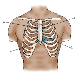 <strong>The nurse is auscultating cardiac tones.Where should the nurse listen to best hear a cardiac murmur related to aortic regurgitation?  </strong> A) Location A B) Location B C) Location C D) Location D <div style=padding-top: 35px> 