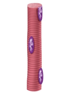In which kind of tissue would you find this?   A) Cardiac muscle B) Smooth muscle C) Skeletal muscle D) Adipose tissue