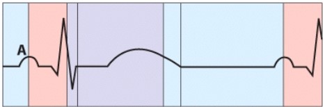What is happening during the phase labeled A?   A) Semilunar valve closure B) AV valve closure C) Atrial depolarization D) Ventricular repolarization
