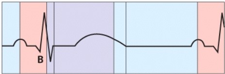 What is happening during the phase labeled B?   A) Atrial depolarization B) Ventricular depolarization C) Ventricular repolarization D) AV valve closure