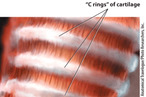 Identify this structure.   A) Pharynx B) Esophagus C) Bronchi D) Trachea