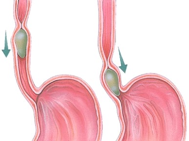 What is the name of the process pictured here?   A) Digestion B) Absorption C) Peristalsis D) Maceration