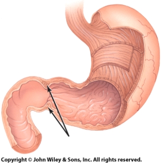 In the diagram,the arrow is pointing at the:   A) rugae sphincter. B) duodenal sphincter. C) esophageal sphincter. D) pyloric sphincter.