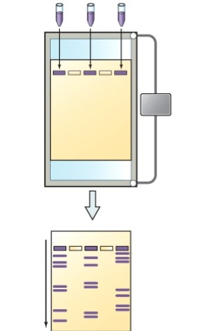 What is the name of the technique shown here?   A) Karyotype B) Polymerase chain reaction C) Human genome project D) Restriction fragment length polymorphism