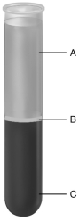    Using the figure above, answer the following questions. -The blood components in C are the ________.