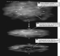 Consider the figure shown below. At which point in time does the collapsing cloud have the greatest angular momentum?   A)  1 B)  2 C)  3 D)  1 and 2, because the protostar has not yet formed. E)  The cloud has the same angular momentum at each point in time.