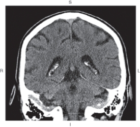 <strong>The figure below illustrates which of the following imaging planes?  </strong> A) Axial B) Coronal C) Sagittal D) Oblique <div style=padding-top: 35px> 