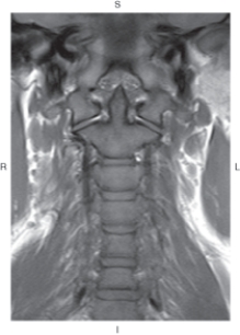 <strong>The figure below illustrates which of the following imaging planes?  </strong> A) Axial B) Coronal C) Sagittal D) Oblique <div style=padding-top: 35px> 