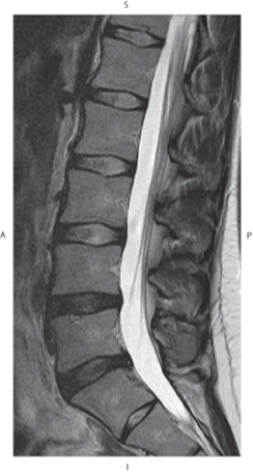 <strong>The figure below illustrates which of the following imaging planes?  </strong> A) Axial B) Coronal C) Sagittal D) Oblique <div style=padding-top: 35px> 