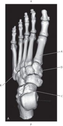 Refer to the figure below of a 3D CT of the foot.    -Which arrow is pointing to the first metatarsal? A)  A B)  B C)  C D)  D