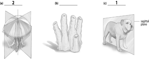 Refer to the figure below, and then answer the following question(s) .    -The missing label indicated by a  1  corresponds to the: A) radial symmetry. B) bilateral symmetry. C) asymmetry.