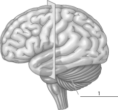 Refer to the figure below, and then answer the question that follows.    -The part of the brain indicated by a  1  corresponds to the: A) thalamus. B) hypothalamus. C) medulla oblongata. D) cerebellum.