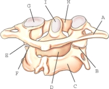 The structure transverse process is labeled _____.  