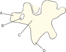 Which aspect of the Scottie dog is the transverse process?     A) A B) B C) C D) D