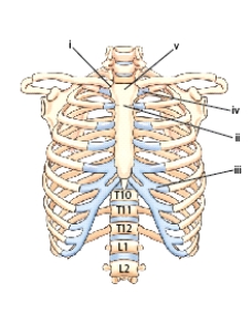What is the name of the part labeled ii?   A) Xiphoid process B) Body C) Sternoclavicular joint D) Sternal angle