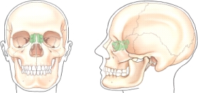 Which group of sinuses is shaded (screened)  in the frontal and lateral views of the illustration below?   A) Maxillary B) Sphenoid C) Ethmoid D) Frontal