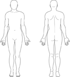 A patient with secondary syphilis may present with a rash. Where should the nurse assess for a rash on this patient? Indicate the areas of the rash with an  X.    