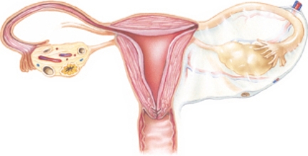 A patient has been diagnosed with salpingitis. Which organs should the nurse identify as being affected by this disease process? Place an  X  over the internal organ affected.   