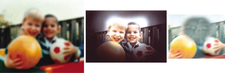 The nurse is caring for a patient with age-related macular degeneration. How should the nurse expect the patient's vision to be?  <div style=padding-top: 35px> 