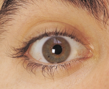 When assessing the external features of the eye, the nurse should be able to identify each accessory eye structure. Which part of the eye should the nurse focus on when assessing the sclera? Place an X on the area that indicates the sclera.   
