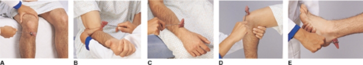 The nurse is planning to assess a patient's brachioradialis reflex. Place an  X  on the picture that represents the technique the nurse will use to test this reflex.   