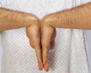 The nurse wants to determine if a patient is experiencing carpel tunnel syndrome. Which test should the nurse use to make this assessment?   A)  bulge sign B)  ballottement C)  Phalen's test D)  Thomas test