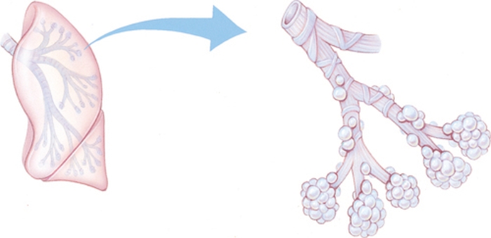 The nurse is reviewing the respiratory structures with a patient diagnosed with emphysema. Which structures should the nurse identify as being affected by this disease? Draw an arrow pointing to the structures most affected by emphysema.   