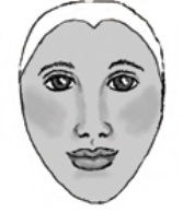 The nurse is assessing a patient's incision after an external sphenoethmoidectomy. Place an  X  on the area of the diagram where this incision would be located.   