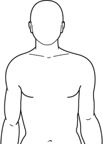 A patient in the critical care area has an invasive hemodynamic pressure monitoring line. This position should be marked on the chest wall as a consistent reference point for calibrating and leveling. Indicate on the diagram where the chest should be marked by placing an  X  at the appropriate reference point.   