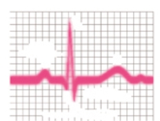 The nurse is analyzing a patient's electrocardiogram. On which area should the nurse focus to analyze the atrial depolarization and contraction? Place an X over the location on the rhythm strip.