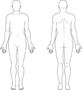 A patient is scheduled for a kidney transplant. Indicate where on the diagrams the nurse instructs the patient that the new kidney will be located.  <div style=padding-top: 35px> 