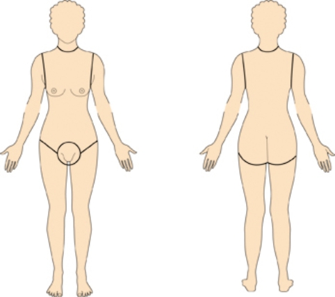 Using the rule of nines, the nurse has estimated that the patient has sustained burns over 99% of the total body surface area (TBSA). Place an  X  on the portion of the body that is most likely unburned in this patient.   