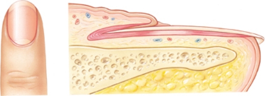 A patient has a history of paronychia. Place an  X  on the area of the fingernail that becomes inflamed in paronychia.   