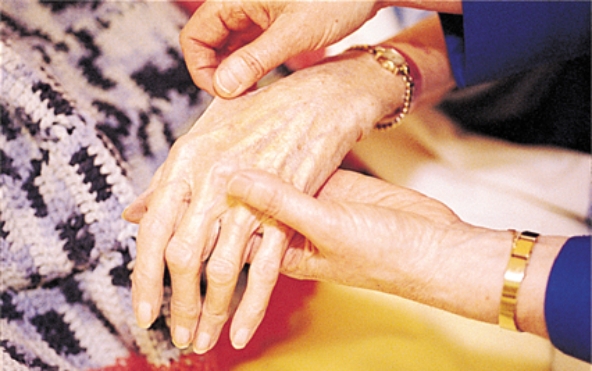 The nurse is assessing a patient's skin. For what is the nurse assessing when using the technique shown in this picture?   A)  hydration status B)  skin temperature C)  skin color D)  liver function