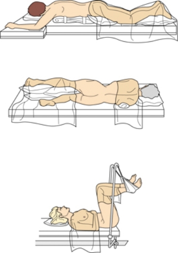 The patient is scheduled for a perineal surgery. Place an X on the position in which the nurse would place this patient for surgery.