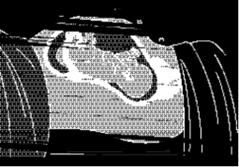 The nurse is preparing the client for an amniocentesis.The ultrasound shows the fetus to be positioned as in the picture.At what site would the nurse prep the client for the amniocentesis?   A) A B) B. C) C. D) D. 