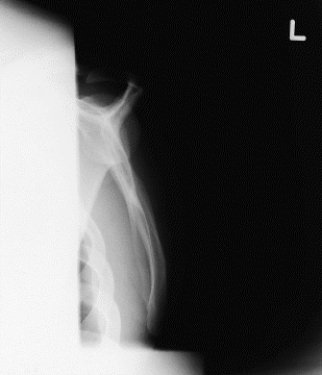 What projection is demonstrated in Figure 19-2?   A)  PA B)  PA oblique C)  AP D)  Lateral→