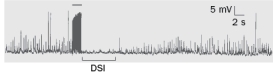 Figure Q10-23 shows an example of endocannabinoid modulation of synaptic strength after high frequency stimulation (indicated by the horizontal bar above the large amplitude activity)  to the presynaptic CA3 neurons. What would happen to the response if the CB1 receptors were blocked?   Figure Q10-23 A)  The frequency of spontaneous IPSPs immediately after the stimulus would decrease compared to their frequency prior to the stimulation. B)  The frequency of spontaneous IPSPs immediately after the stimulus would increase compared to their frequency prior to the stimulation. C)  The frequency of the spontaneous IPSPs would not change immediately after the stimulus compared to the frequency of spontaneous IPSPs prior to the stimulation. D)  The amplitude of the spontaneous IPSPs would increase immediately after the stimulus, compared to their amplitude prior to the stimulation. E)  The amplitude of the spontaneous IPSPs would decrease immediately after the stimulus, compared to their amplitude prior to the stimulation. 