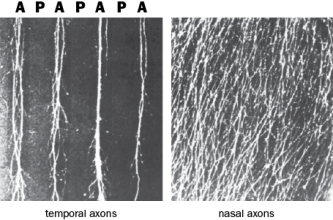Temporal and nasal RGC axons behave very differently in the stripe assay with alternating anterior and posterior tectal membranes, as seen in Figure Q5-4.   Figure Q5-4 A. What possible interpretations can be drawn from the selective growth of temporal RGC axons in this assay? B. What possible interpretations can be drawn from the indiscriminate growth of nasal RGC axons in this assay?