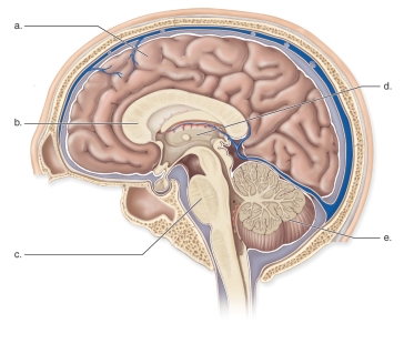   -This figure shows the anatomy of the human brain.Which part is represented by  c ? A) Pons B) Cerebellum C) Corpus callosum D) Thalamus E) Cerebrum