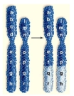 The following picture depicts which of the following changes in chromosome structure.   A) deletion B) duplication C) translocation D) aneuploidy