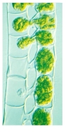 Identify the Supergroup the organism in the picture below belongs in and describe the process that is occurring.  