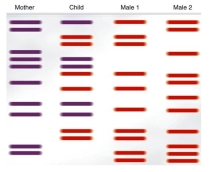 DNA fingerprinting may be used to establish paternity. Analyze the banding pattern to determine the father of the child.   A)  Male 1 B)  Male 2 The father of the child is Male 1, not Male 2. 