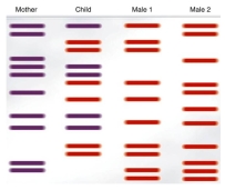 DNA fingerprinting may be used to establish paternity. Analyze the banding pattern pictured at right to determine the father of the child. How did you arrive at your answer?  