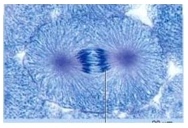 What phase of mitosis is pictured?   A)  prophase B)  prometaphase C)  metaphase D)  anaphase E)  telophase 